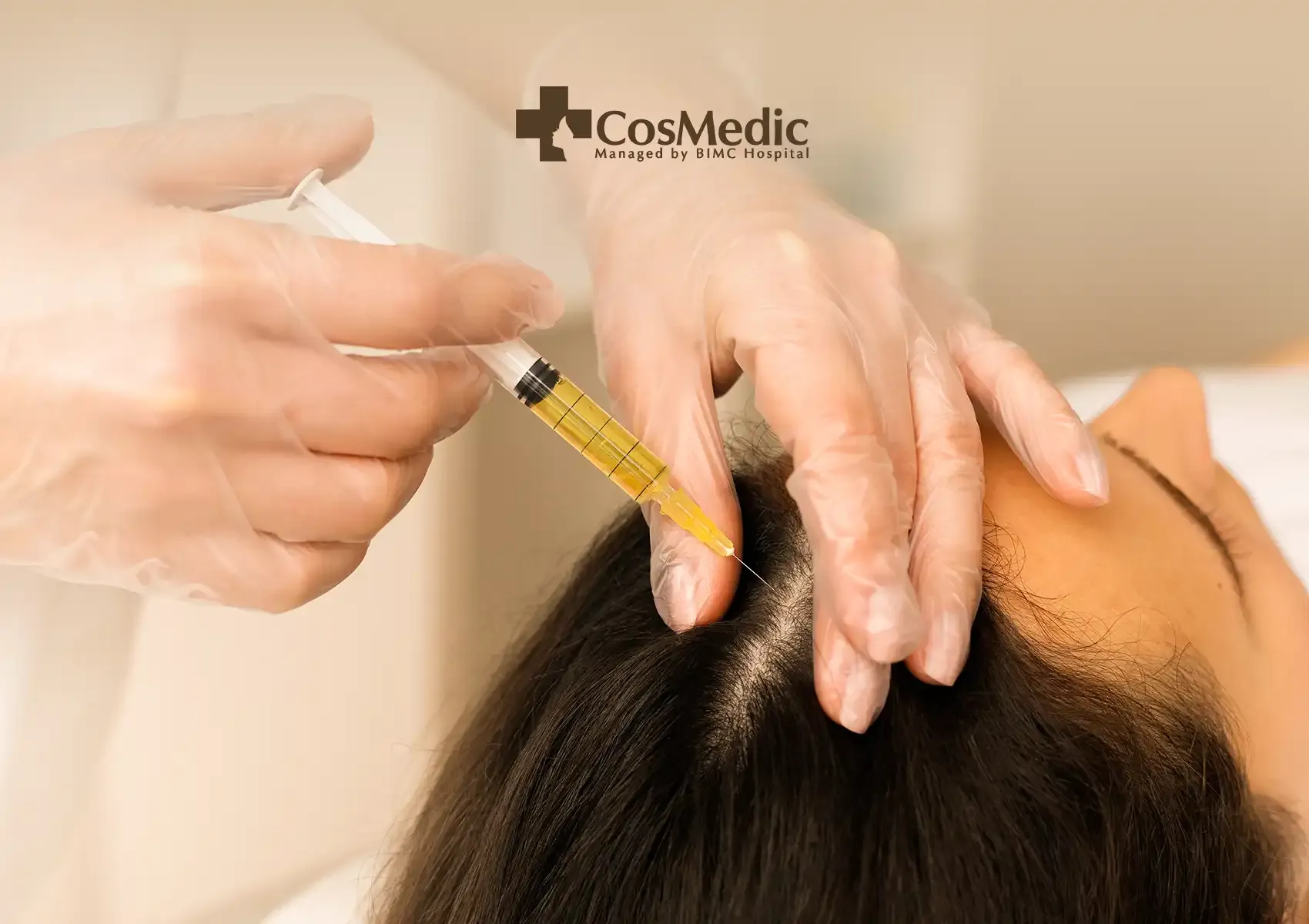 PRP Therapy for Early Hair Loss