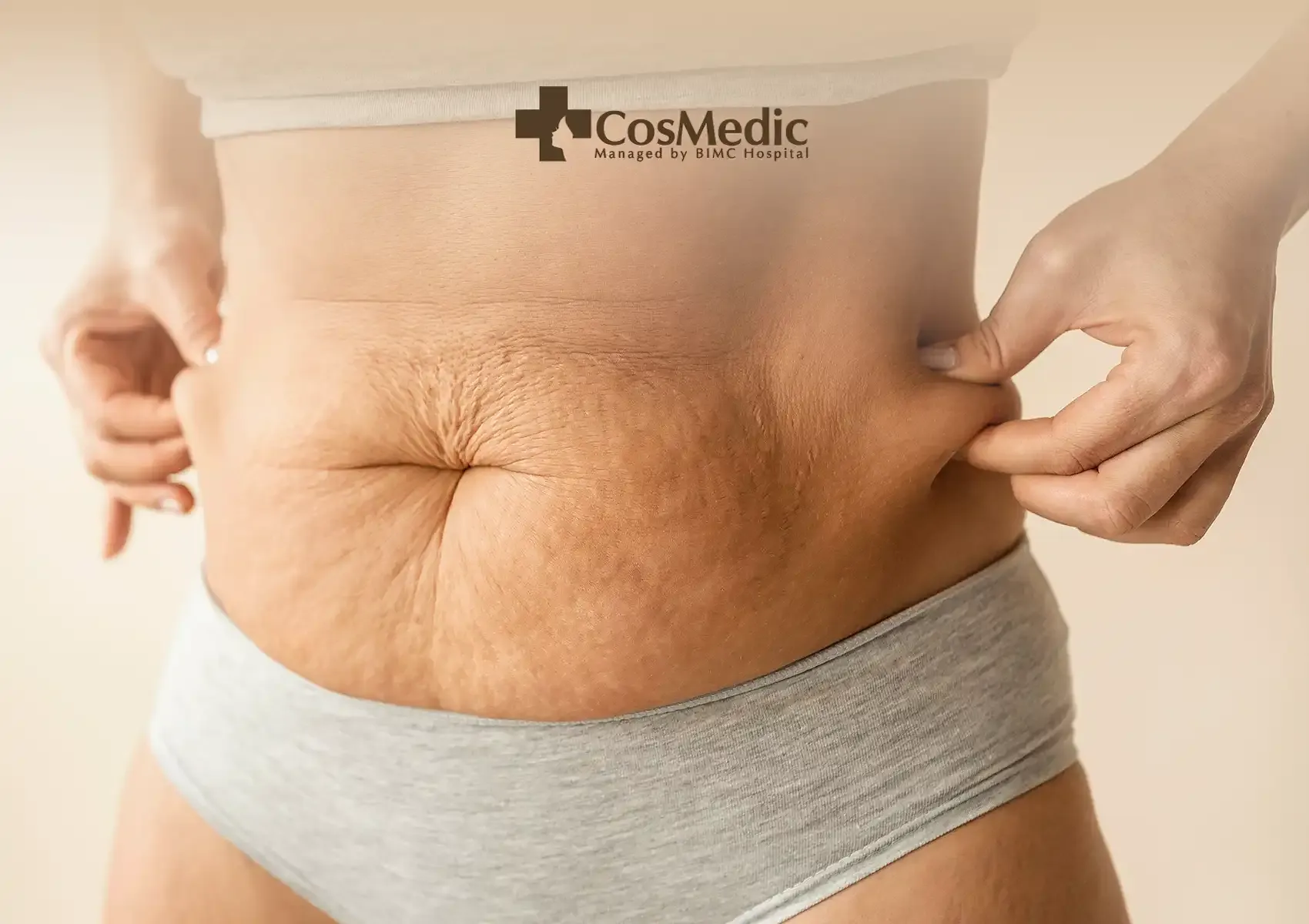 Knowing the Types of Tummy Tucks Before You Decide